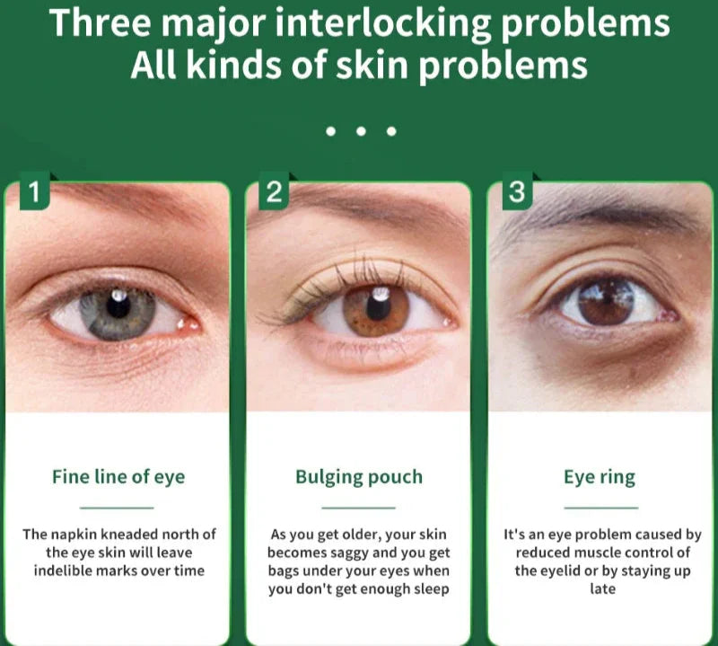 Anti-Wrinkle Photon Therapy Facial & Eye Massager Green