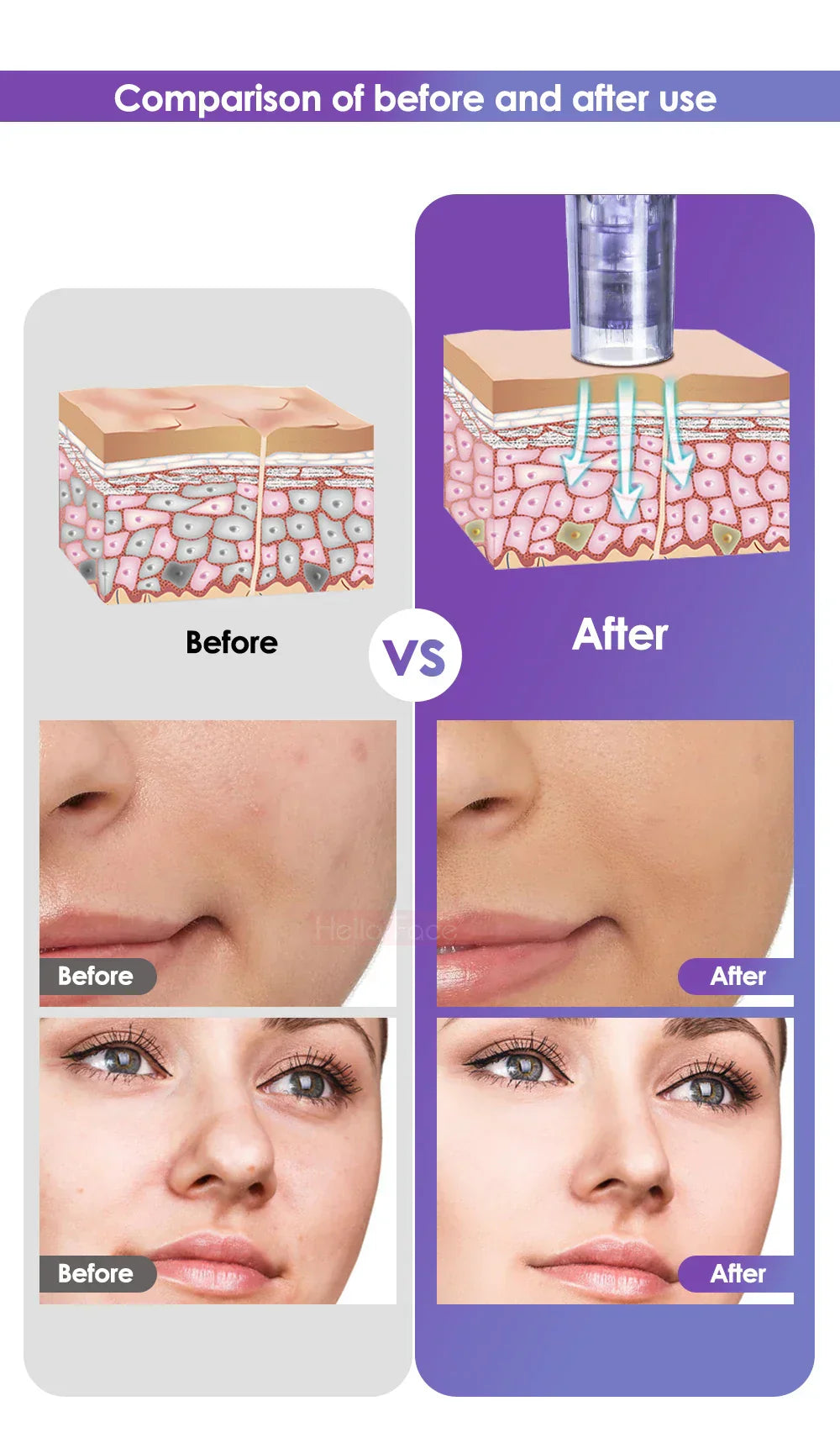 2-in-1 Hydra Whitening Injector with Aqua Derma Pen