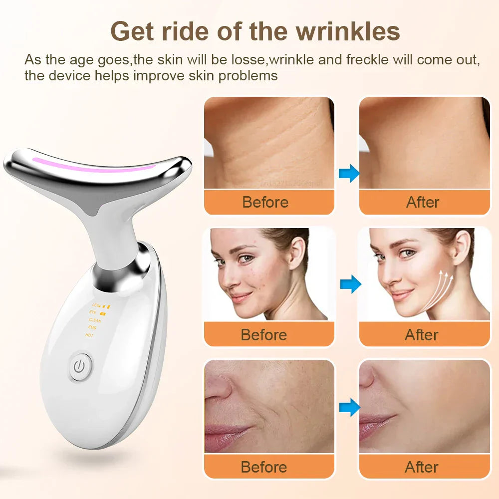 EMS Neck Face Lifting Massager - LED Photon Therapy, Wrinkle Remover ES-1081