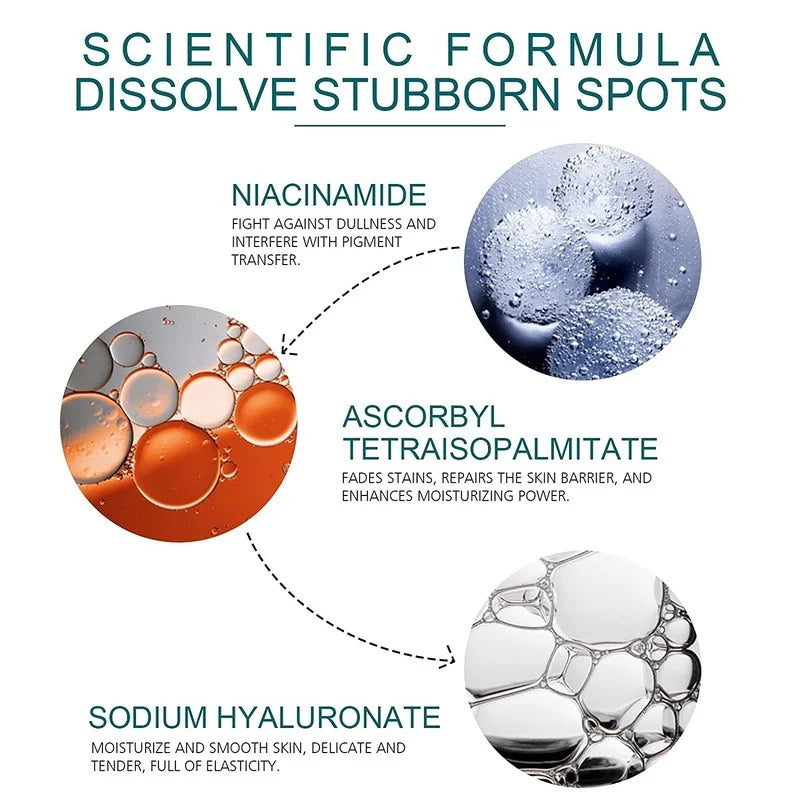 Whitening Freckles Cream - Korean Skincare