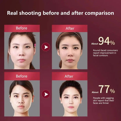 LED Photon Therapy Facial Lifting Massager