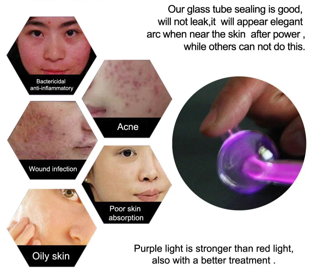 High Frequency Facial Machine with Argon Treatment - Electrotherapy Wand for Acne and Hair Care