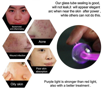 High Frequency Facial Machine with Argon Treatment - Electrotherapy Wand for Acne and Hair Care