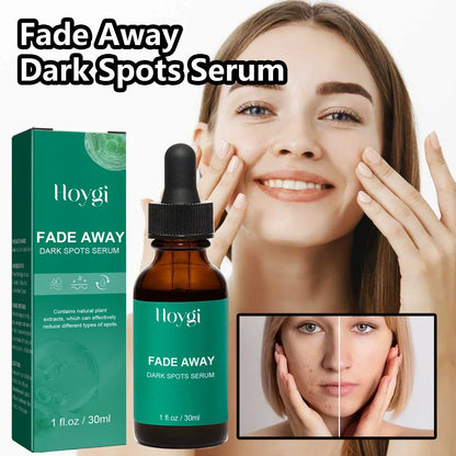 Dark Spot Remover Serum - Targets Sun Spots, Melasma, Freckles