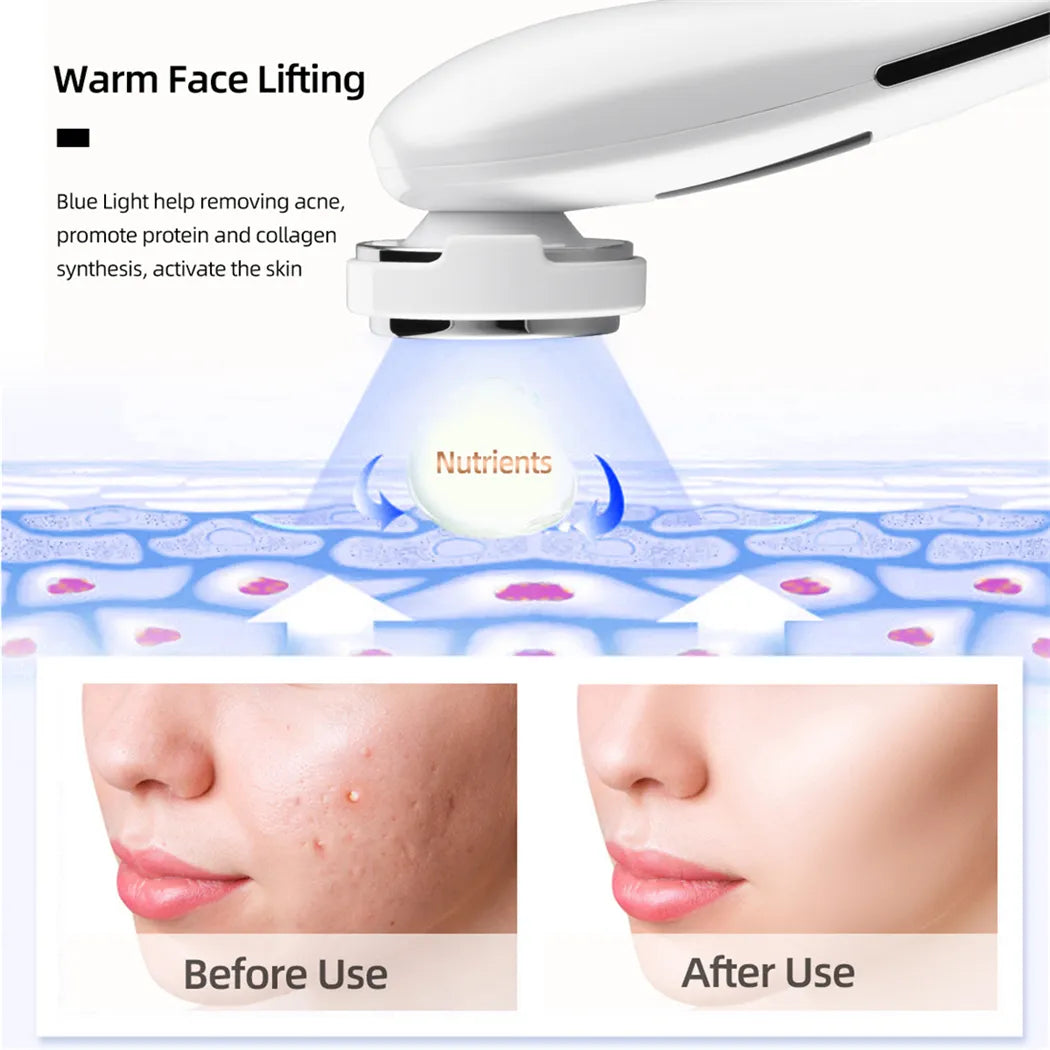 Ultrasonic Skin Scrubber, EMS Massager, LED Light Therapy Beauty - Illuminate, Lift, and Rejuvenate Your Skin
