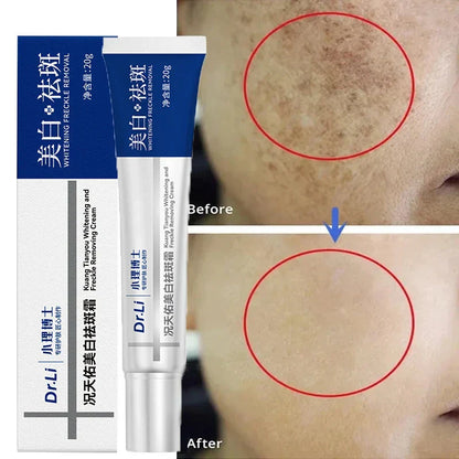 Whitening Freckles Cream - Korean Skincare