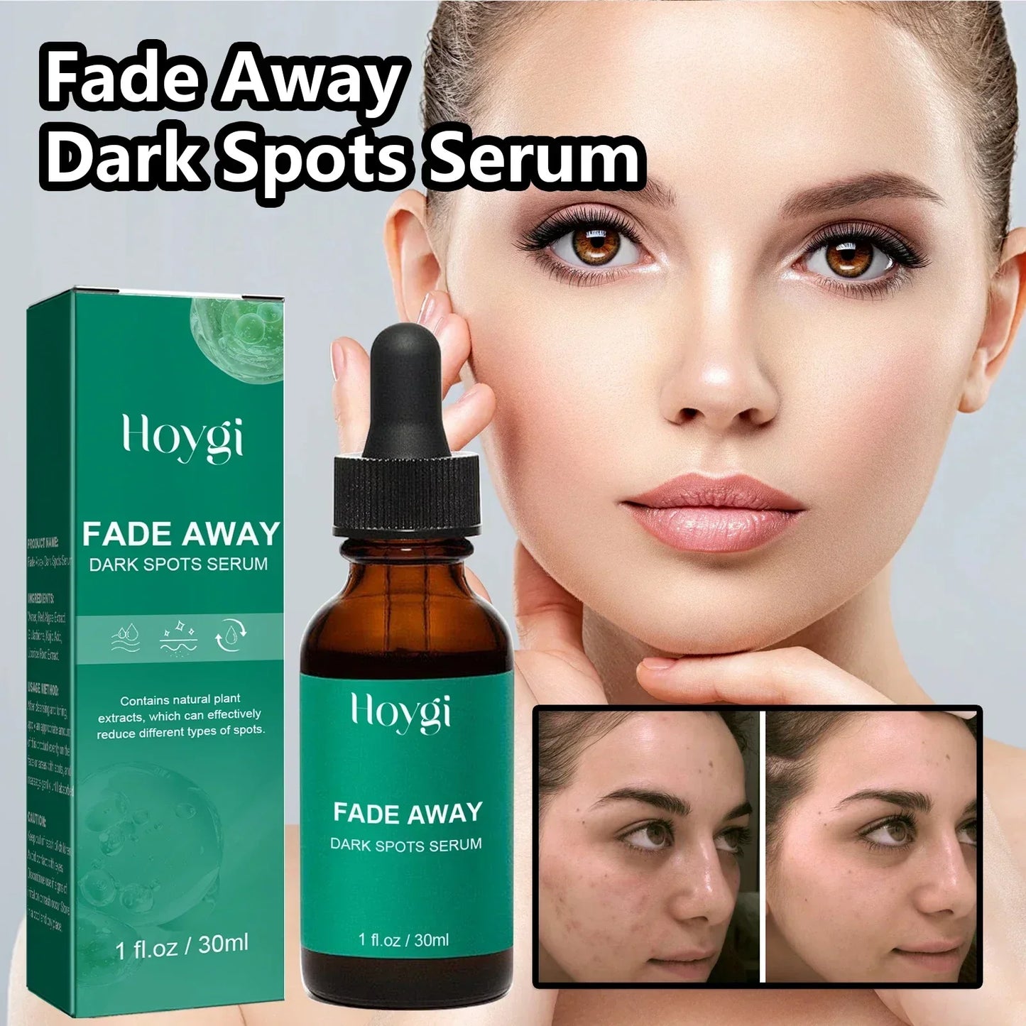 Dark Spot Remover Serum - Targets Sun Spots, Melasma, Freckles