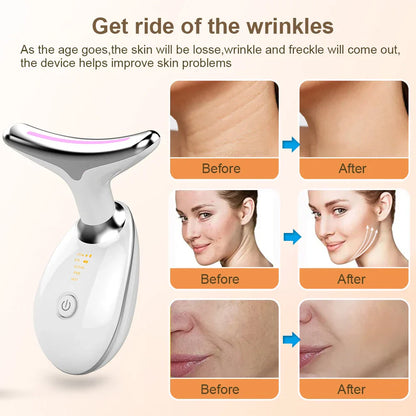 EMS Neck Face Lifting Massager - LED Photon Therapy, Wrinkle Remover ES-1081