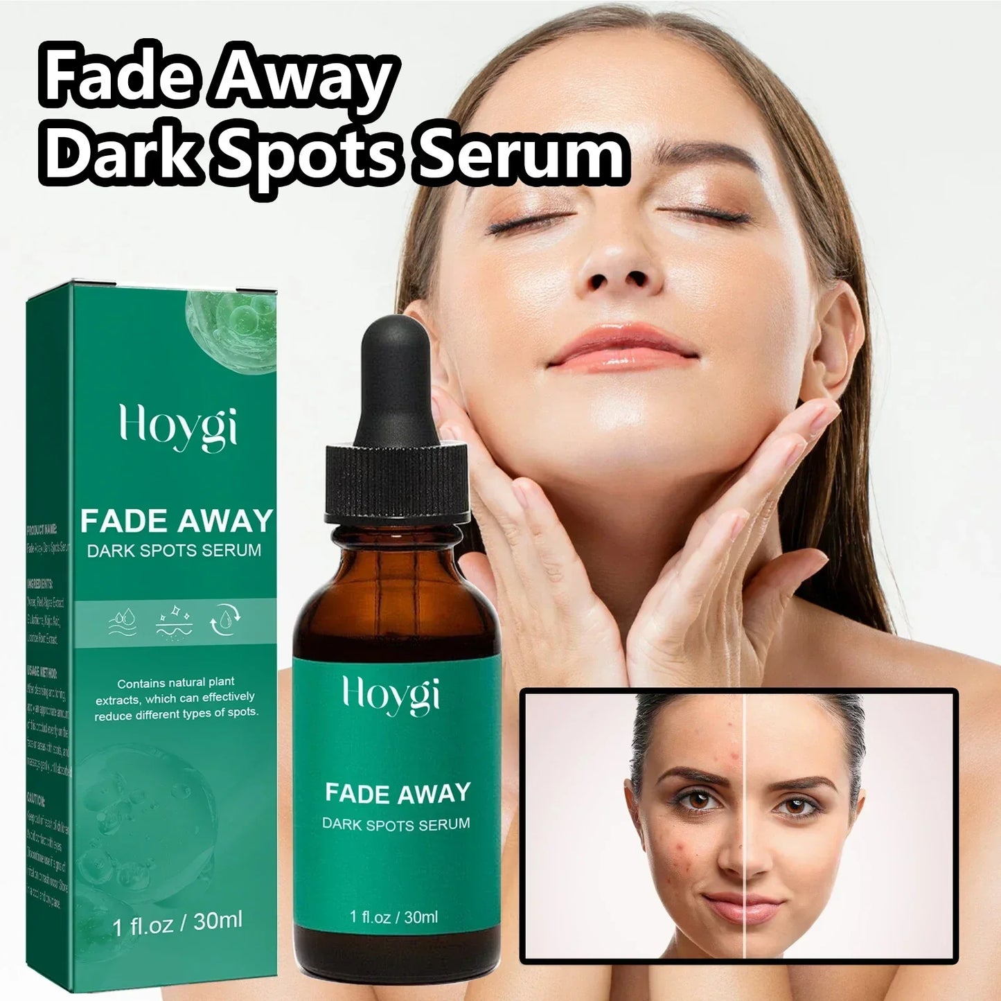 Dark Spot Remover Serum - Targets Sun Spots, Melasma, Freckles
