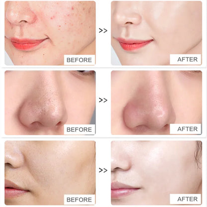 Amino Acid Facial Cleanser: Specialized Whitening for Women and Genuine Oil Control for Men