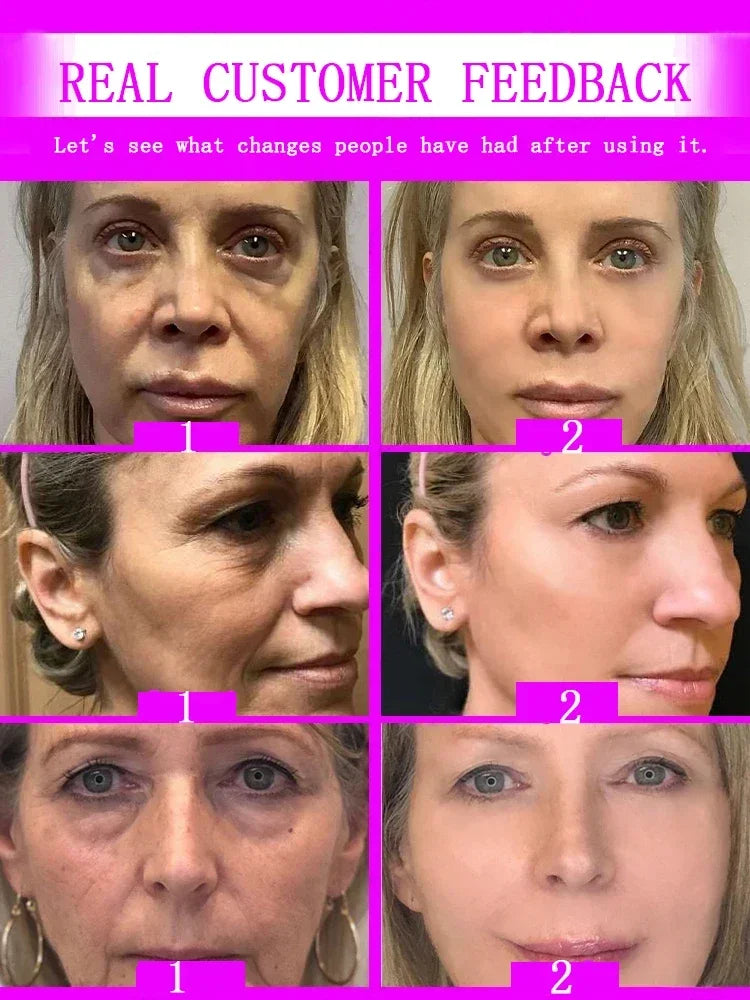 Instant Wrinkle Relief: Korea Cosmetic Anti-Aging Serum