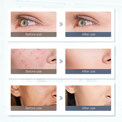 7 Colors LED Face & Neck Mask - Phototherapy for Skin Rejuvenation