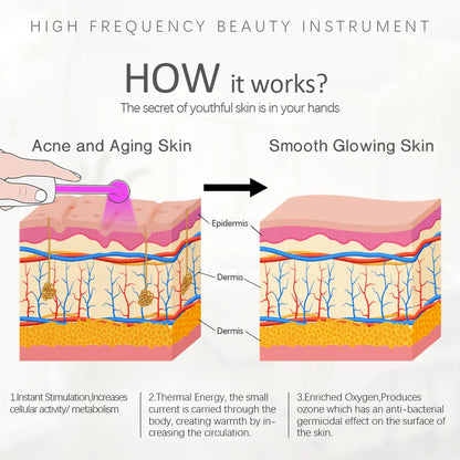 4-in-1 Portable High-Frequency Beauty Device - Spot Remover, Facial Care, Spa Derma Wand