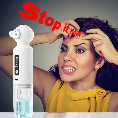 6-Head Electric Blackhead Vacuum Cleaner